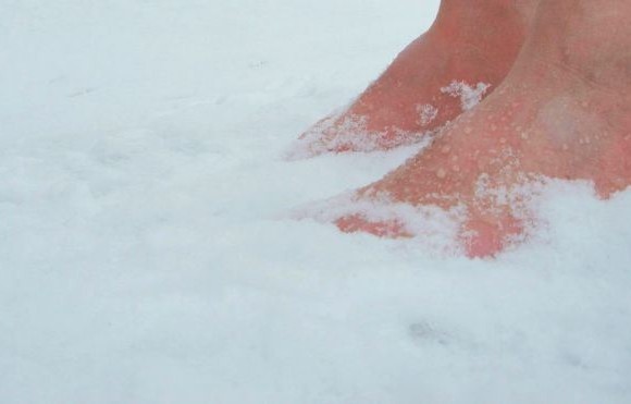 Taking care of your feet in the winter months