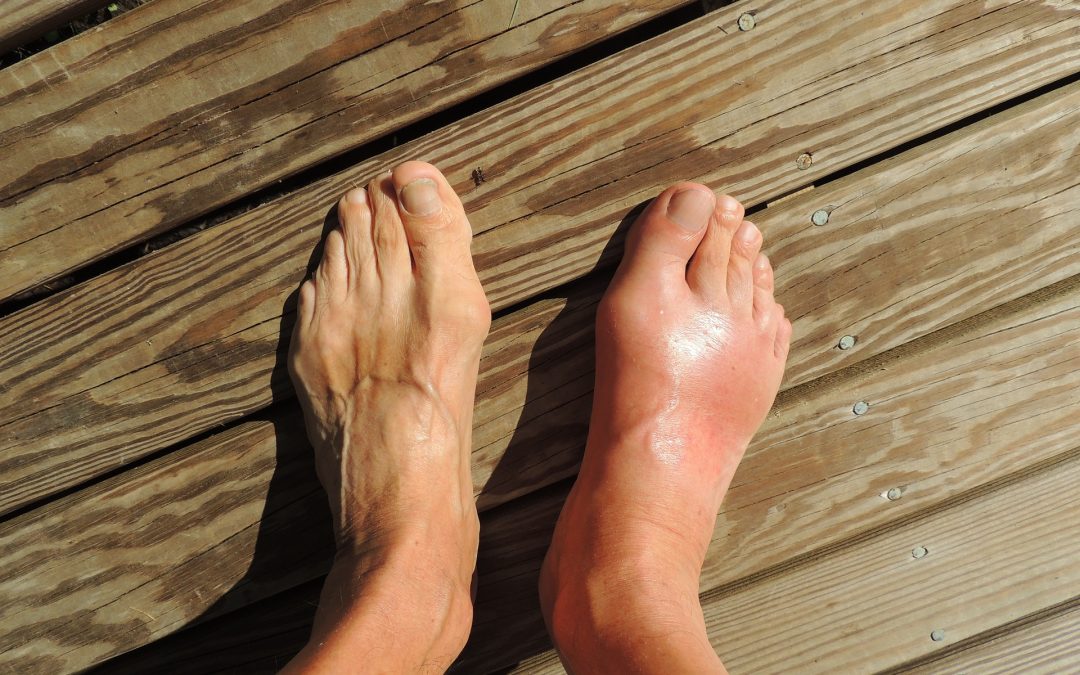top of foot pain possible causes